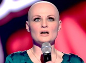 Girl Who Lost Her Hair at Age 21 Stuns Judges - This is So Moving