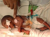 Couple Asks God to Save Their 1 Pound Baby - Then a Miracle Happens