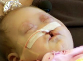 Doctors Said This Baby Should Not Live - But God Had a Plan for Pearl =)