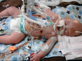 Bodie the Miracle Baby's Story Will Amaze You