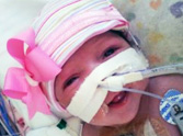 Baby Girl is Born Without a Heart in Her Body - and She SURVIVES