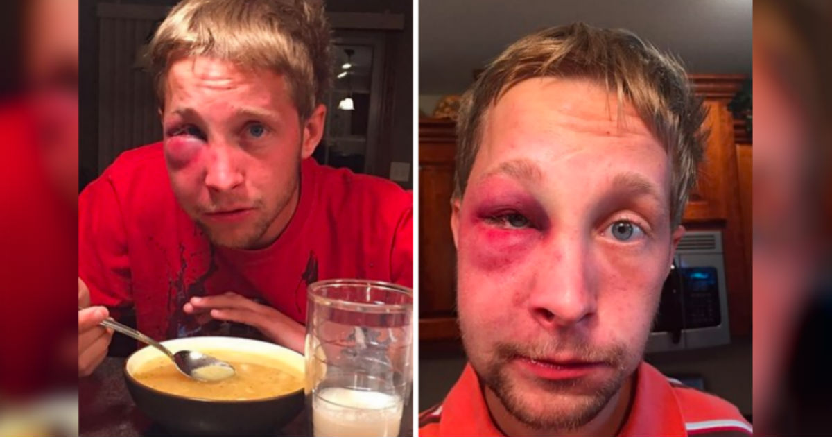 He Was Beat Up For Being ‘Weird.’ But How He Responded To His Bully...Amazing!