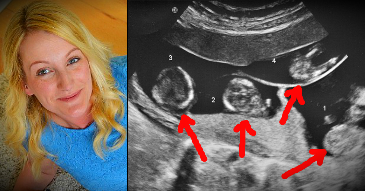 God Sent This Mom 4 Miracles After Doctors Said She'd Never Conceive!