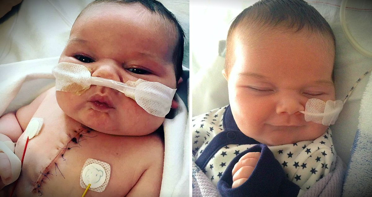 Miracle Baby Smiles After Being Born With Half A Heart